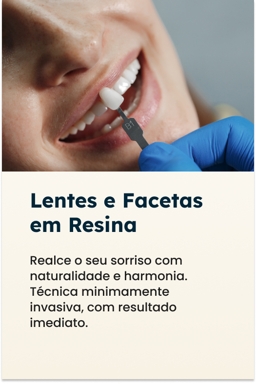 lentes-6.png